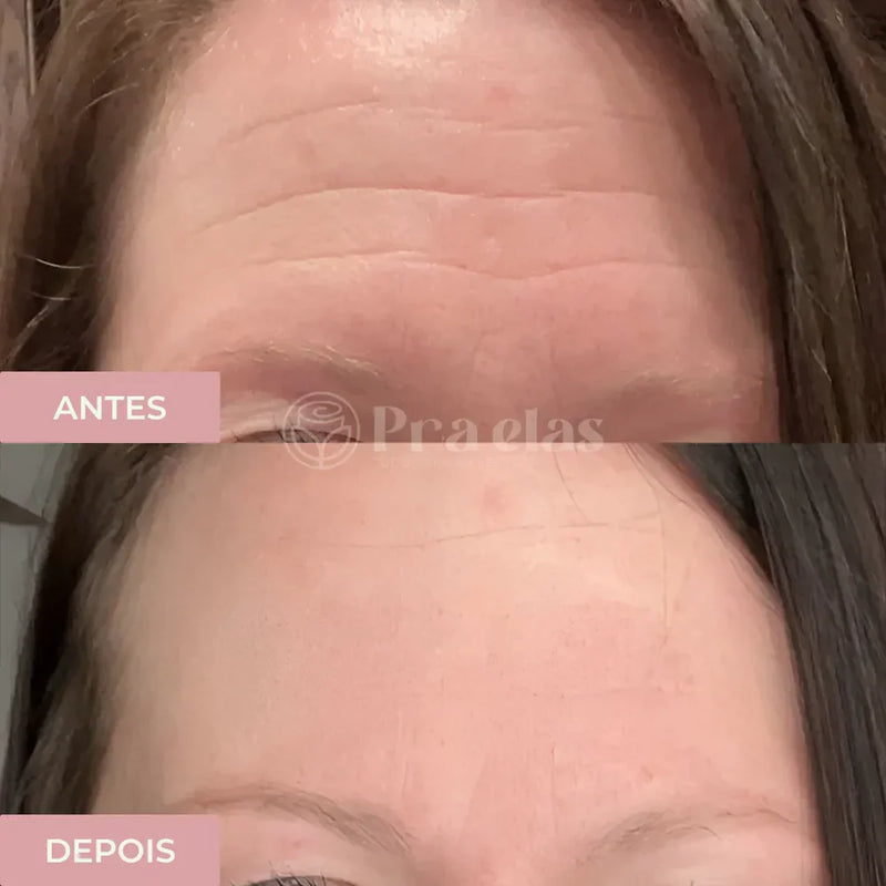 Creme Antirrugas Instantâneo - (Compre 1 Leve 2) ®