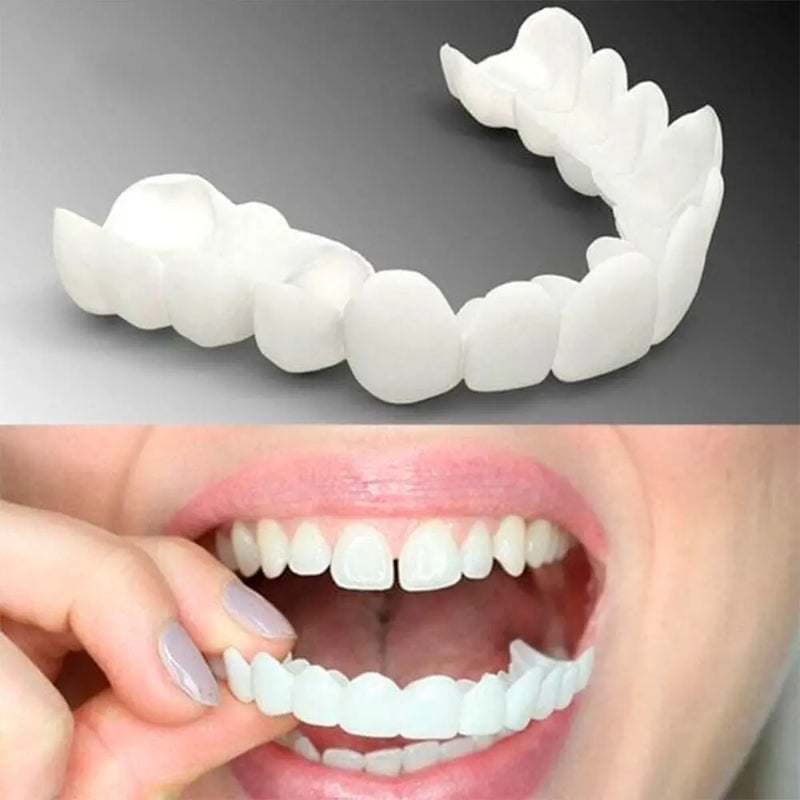 Faceta Dental White - Inferior e Superior (Compre 1 Leve 2)