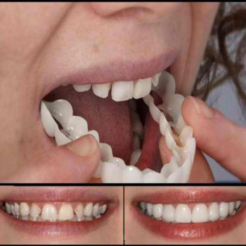 Faceta Dental White - Inferior e Superior (Compre 1 Leve 2)